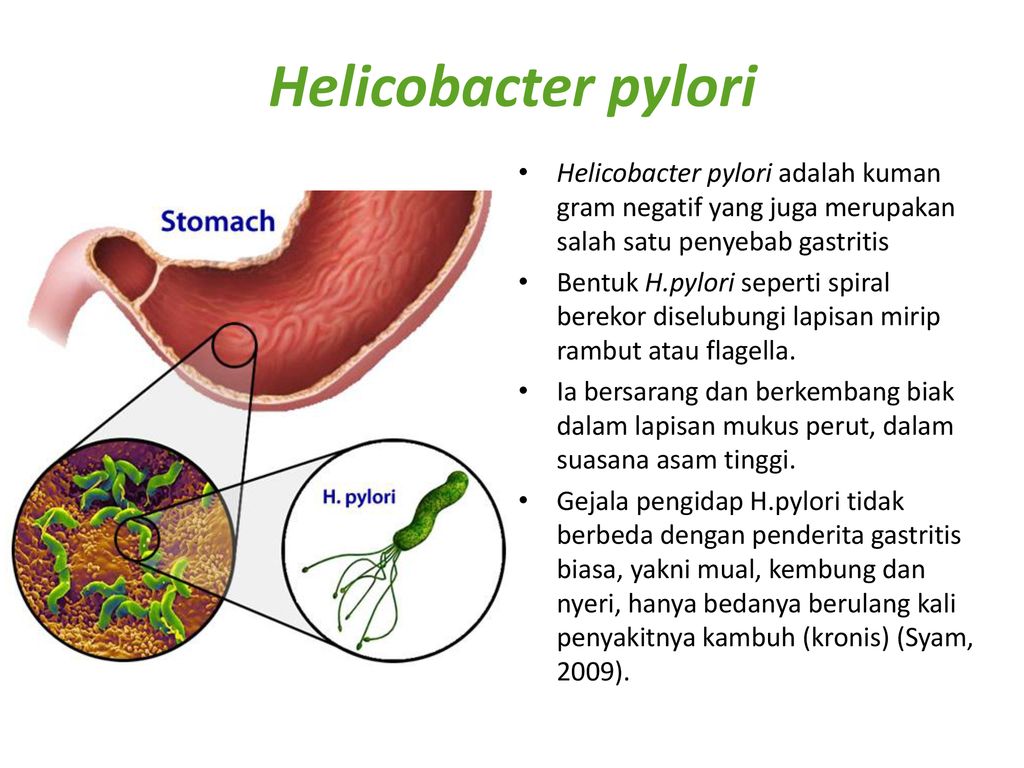 Eliminar helicobacter pylori
